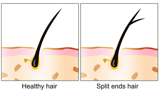 Healthy hair and split ends hair with scalp layer
