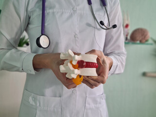 Experienced doctor in medical uniform holds artificial model of vertebra