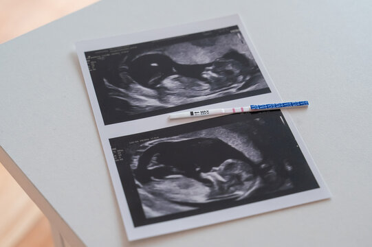 Positive pregnancy test in a photo from an ultrasound on a white table. 