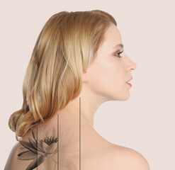 Design with photo of woman on beige background during tattoo removal process