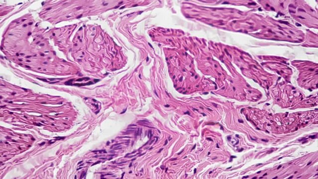 Section of human bladder under microscope 400x against bright field background. View of piece of people organ storing urine in void condition. Looking for infection in the laboratory for healthcare