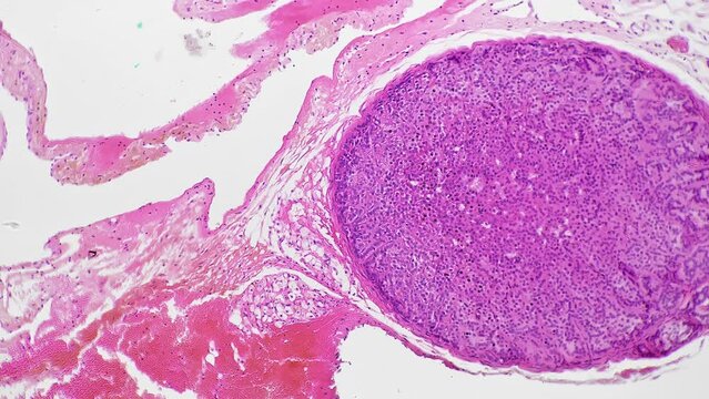 Section of human adrenal gland filmed under microscope 100x on white background. Macro footage of people organ showing its different layers of cells. Producing steroid hormones theme. Anatomy concept.