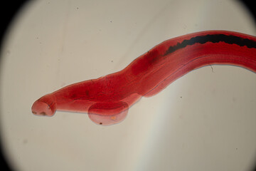 photo of human parasite worms under the microscope - obrazy, fototapety, plakaty