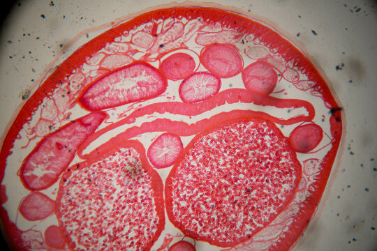 photo of human parasite worms under the microscope
