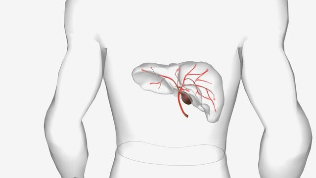 Primary Biliary Cholangitis Cirrhosis 3d animation
