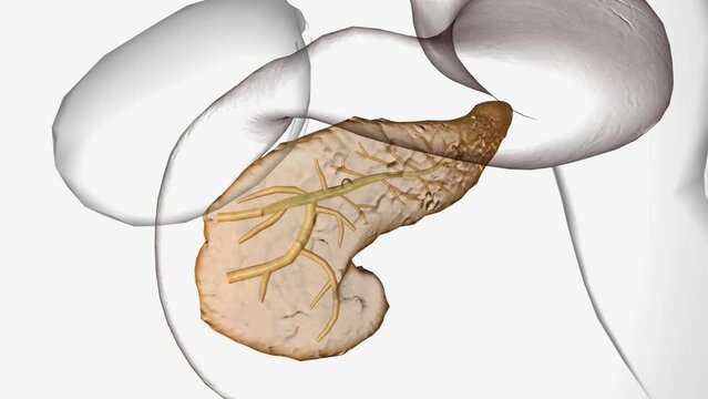 The Cystic Fibrosis in Pancreas