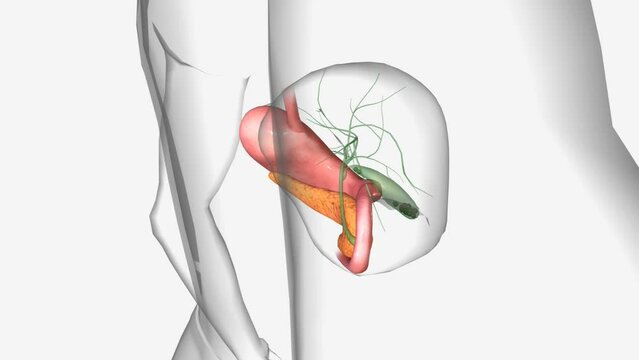 Gallstones are pebble-like pieces of bile that develop in your gallbladder.