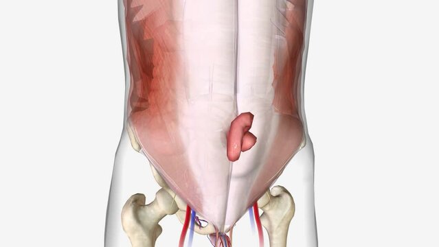 A ventral or incisional hernia specifically describes a hernia, often in the middle of the abdomen