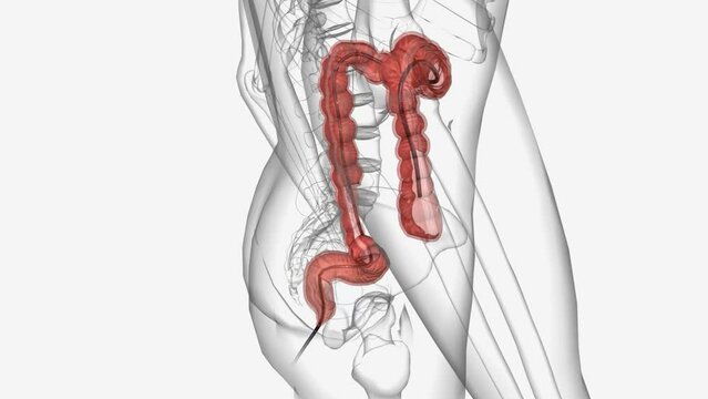 Colonoscopy is a procedure in which a doctor uses a colonoscope or scope, to look inside your rectum and colon.