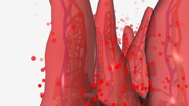 Inflammatory bowel disease (IBD) is a group of disorders that cause chronic inflammation (pain and swelling) in the intestines.