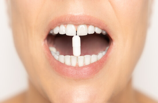 Personne avec un pilule de médicament ou complément alimentaire entre les dents