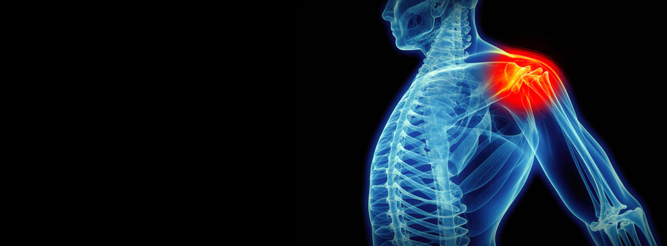 X-ray of a human body with a red mark on the shoulder. Shoulder pain concept motif banner.