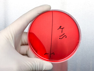 Microbial experimenters are conducting experiments in modern laboratory.
