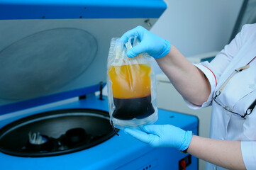 Lab assistant s hands holding container with blood plasma and red blood cells separated, centrifuge on a background