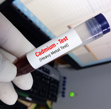 Urine sample for cadmium (heavy metal) test, toxic metal.