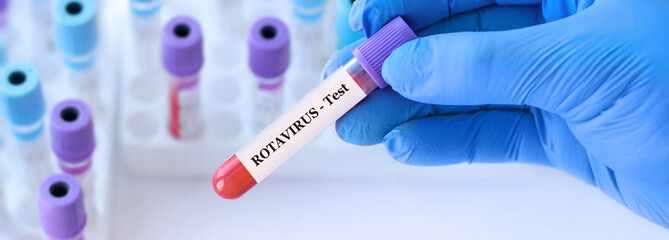 Fototapeta premium Doctor holding a test blood sample tube with Rota virus test on the background of medical test tubes with analyzes.