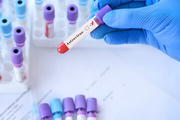 Doctor holding a test blood sample tube with Astrovirus PCR test on the background of medical test tubes with analyzes.