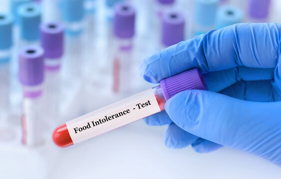 Doctor holding a test blood sample tube with food intolerance test on the background of medical test tubes with analyzes.Copy space for text