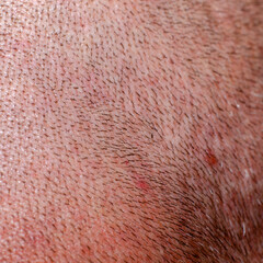 Shaved human skin on head close-up