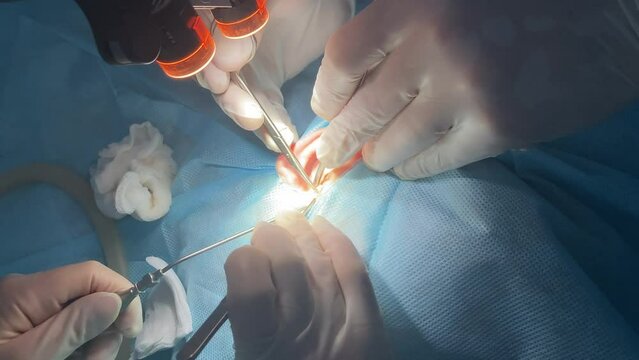 Surgery operation. Close up of surgery hands take off wadding tampon in blood. Doctor hand care wound. Surgical treatment concept. Medical hands performing operation with surgery tools