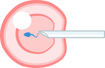 IVF ICSI vector illustration. Perfect for presenting anything about reproduction, insemination or ivf.