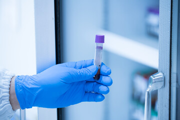 Medical scientist wearing blue gloves holding blood test tube in medical laboratory.Chemistry researcher holds a sample tube does a chemical experiment and examines a patient's blood sample.