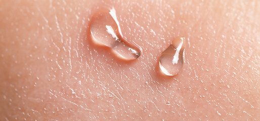Fototapeta premium Collagen And Hyaluron Serum Gel On Skin. Splashing of Hyaluron gel. Liquid hyaluronic acid gel on skin. Cosmetic water gel texture on human skin background. Textured background. skin care product.