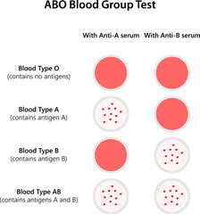ABO Blood Group Test