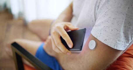 Man Using Continuous Glucose Remote Monitor Diabetes