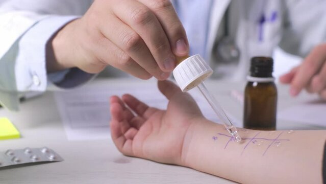 Allergist using a pipette with different allergens on a arm Skin of a person, Close-up