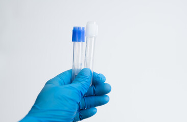 Two acuum tubes for collection and blood samples with sodium citrate in blue gloves for laboratory. On white background