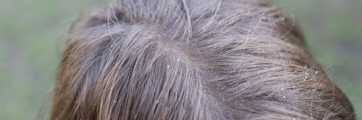 Drops of water on child hair closeup