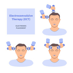 Electroconvulsive therapy for severe depression and schizophrenia treatment. ECT electrodes placement. Brain stimulation equipment for bipolar, major depressive disorders. Vector medical illustration