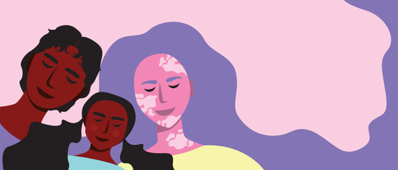 Diverse multicultural family and vitiligo parents with child as copy space template or backdrop with place for text, flat vector stock illustration