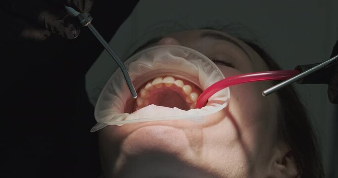 Dentist rinses patient's mouth with jet of water, saliva ejector takes away the excess liquid. Dental treatment procedure, close-up.