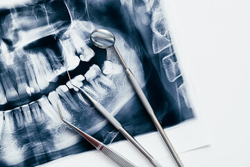 Dental toold and jaw x-ray. Dental treatment concept