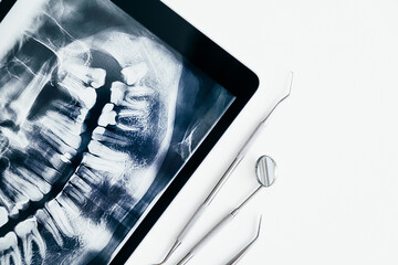 Dental instruments and jaw x-ray on white table. Panoramic digital jaw x-ray on tablet, white background.