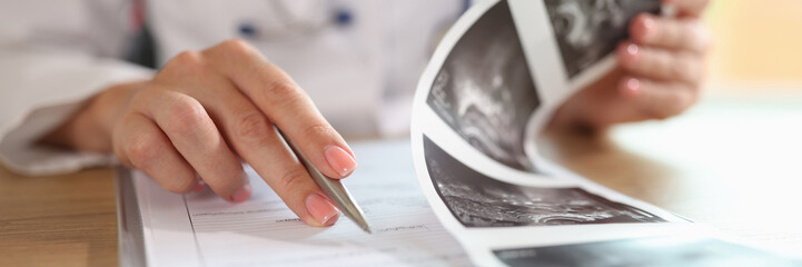 Gynecologist examines results of examination of uterus