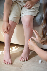 mother smears her child with ointment for mosquito bites.
