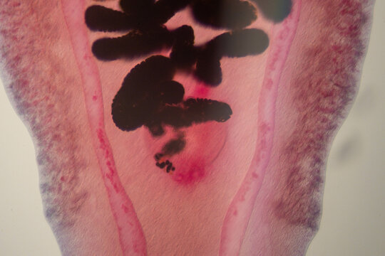 photo of human parasite worms under the microscope