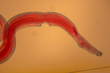 photo of human parasite worms under the microscope