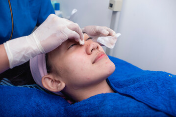 A patient has a facial prior to a cosmetic surgery procedure. Cleaning the bridge of the nose of a client with wet wipes, removing oil, makeup, and other residue. Preoperative preparation.