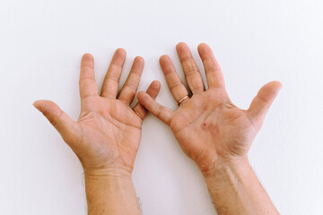 Male hands with calluses, palms forward, fingers bent