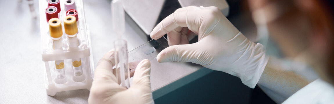 Female technician in latex gloves holds glass slide with transparent liquid drop at workplace