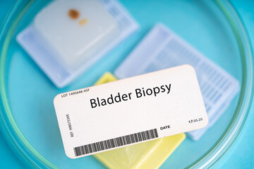 Bladder Biopsy