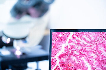 Modern microscope and human tissue section slide with computer monitor show glandular image.Medical...