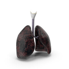 Smokers lungs stage heavy