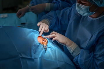 Obraz na płótnie Canvas Woman doctor preparing for eye surgery. Ophthalmological clinic.