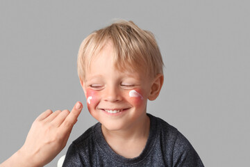 Mother applying cream onto her allergic little son's face on grey background, closeup