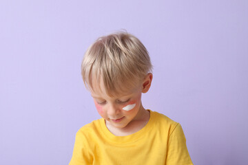 Allergic little boy with sunburned face and cream on lilac background, closeup